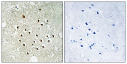 Anti-RPS19BP1 antibody used in IHC (Paraffin sections) (IHC-P). GTX87106