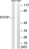 Anti-SVOP antibody used in Western Blot (WB). GTX87119