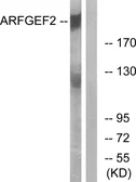 Anti-ARFGEF2 antibody used in Western Blot (WB). GTX87126