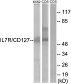 Anti-IL7 Receptor alpha antibody used in Western Blot (WB). GTX87162