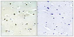 Anti-S100A16 antibody used in IHC (Paraffin sections) (IHC-P). GTX87170