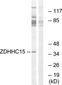 Anti-ZDHHC15 antibody used in Western Blot (WB). GTX87194