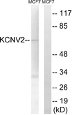 Anti-KCNV2 antibody used in Western Blot (WB). GTX87208