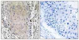 Anti-CBLN3 antibody used in IHC (Paraffin sections) (IHC-P). GTX87227