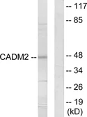 Anti-CADM2 antibody used in Western Blot (WB). GTX87260