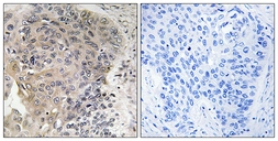 Anti-AGBL3 antibody used in IHC (Paraffin sections) (IHC-P). GTX87267