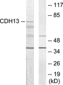 Anti-CDH13 antibody used in Western Blot (WB). GTX87281