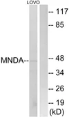 Anti-MNDA antibody used in Western Blot (WB). GTX87295