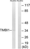 Anti-TMBIM1 antibody used in Western Blot (WB). GTX87296