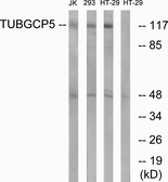 Anti-TUBGCP5 antibody used in Western Blot (WB). GTX87308