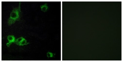 Anti-LAMA1 antibody used in Immunocytochemistry/ Immunofluorescence (ICC/IF). GTX87333