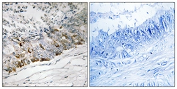 Anti-GCHFR antibody used in IHC (Paraffin sections) (IHC-P). GTX87369