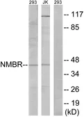Anti-NMBR antibody used in Western Blot (WB). GTX87422