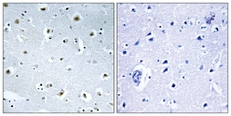 Anti-TUBGCP3 antibody used in IHC (Paraffin sections) (IHC-P). GTX87444