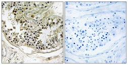 Anti-DYNLRB2 antibody used in IHC (Paraffin sections) (IHC-P). GTX87503