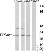 Anti-RPS4Y1 antibody used in Western Blot (WB). GTX87517