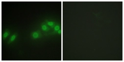 Anti-LATS2 antibody used in Immunocytochemistry/ Immunofluorescence (ICC/IF). GTX87529