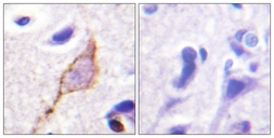 Anti-Kv7.3 / KCNQ3 antibody used in IHC (Paraffin sections) (IHC-P). GTX87558