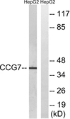 Anti-Cav gamma 7 antibody used in Western Blot (WB). GTX87562