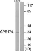 Anti-GPR174 antibody used in Western Blot (WB). GTX87624