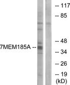 Anti-TMEM185A antibody used in Western Blot (WB). GTX87650