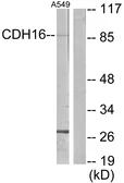 Anti-CDH16 antibody used in Western Blot (WB). GTX87660