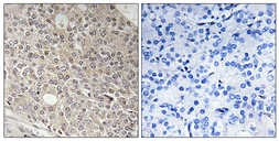 Anti-AMOTL1 antibody used in IHC (Paraffin sections) (IHC-P). GTX87689