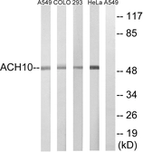 Anti-AChR alpha 10 antibody used in Western Blot (WB). GTX87783