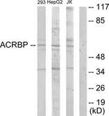 Anti-ACRBP antibody used in Western Blot (WB). GTX87784