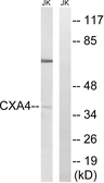 Anti-GJA4 antibody used in Western Blot (WB). GTX87800