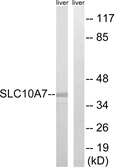 Anti-SLC10A7 antibody used in Western Blot (WB). GTX87802