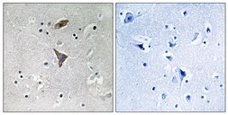 Anti-KCNT1 antibody used in IHC (Paraffin sections) (IHC-P). GTX87812