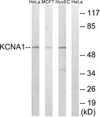 Anti-Kv1.1 antibody used in Western Blot (WB). GTX87837