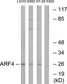 Anti-ARF4 antibody used in Western Blot (WB). GTX87894