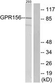 Anti-GPR156 antibody used in Western Blot (WB). GTX87902