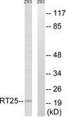 Anti-MRPS25 antibody used in Western Blot (WB). GTX87909