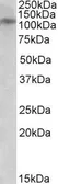 Anti-NMDAR3B antibody, C-term used in Western Blot (WB). GTX88061