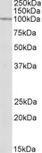 Anti-CLCN2 antibody, Internal used in Western Blot (WB). GTX88176