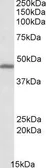 Anti-GPR17 antibody, C-term used in Western Blot (WB). GTX88292