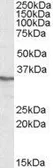 Anti-PPP4C antibody, C-term used in Western Blot (WB). GTX88412