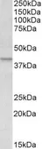Anti-Apolipoprotein L1 antibody, C-term used in Western Blot (WB). GTX88518