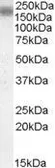 Anti-LRP4 antibody, Internal used in Western Blot (WB). GTX88580