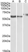 Anti-P2X4 antibody, C-term used in Western Blot (WB). GTX88599