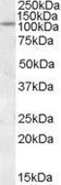 Anti-PTPRN antibody, Internal used in Western Blot (WB). GTX88611