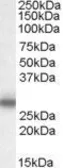 Anti-MPZ antibody, Internal used in Western Blot (WB). GTX88751