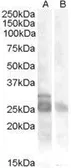 Anti-MYF5 antibody, Internal used in Western Blot (WB). GTX88776