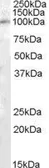 Anti-PAM antibody, C-term used in Western Blot (WB). GTX88835