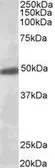 Anti-GIRK2 antibody, C-term used in Western Blot (WB). GTX88962