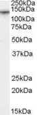 Anti-CACNA2D1 antibody, Internal used in Western Blot (WB). GTX89045