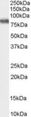 Anti-KCNC3 antibody, C-term used in Western Blot (WB). GTX89119